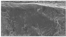 圖11-154 斷面A1、A2區(qū)邊沿微觀形貌